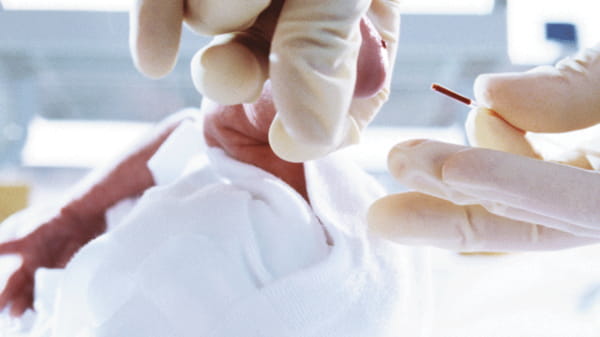 Obrázek používané kapilární zkumavky Clinitube